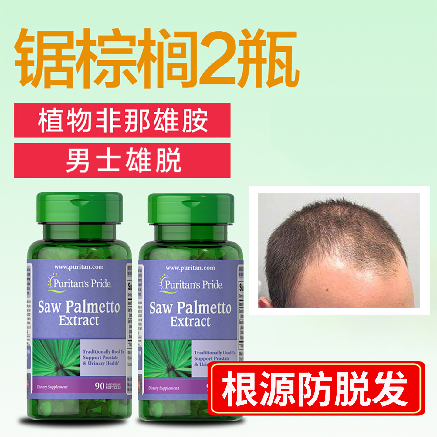 锯棕榈生胶囊食品发胺dht阻断剂