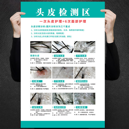 头皮检测对比图海报头疗图片