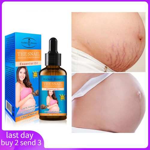 marks scar Pregnancy wrinkle essential oil Stretch 补水提拉