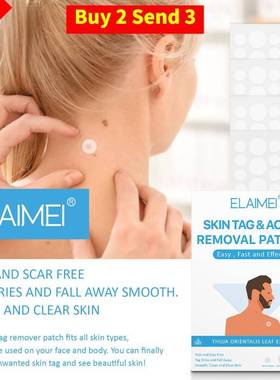 Skin Tag Remover Patch Nature Ingredi Label 144PCS Dry fall