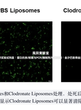 APExBIO巨噬细胞清除试剂盒Macrophage Depletion Kit高清除效率