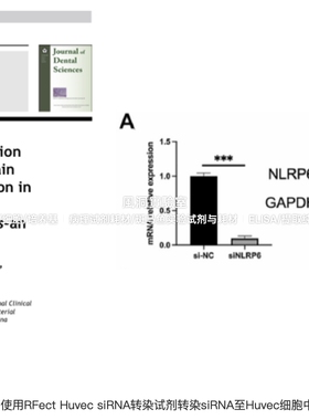 Rfect Huvec siRNA/miRNA转染试剂，专用内皮细胞siRNA/miRNA转染
