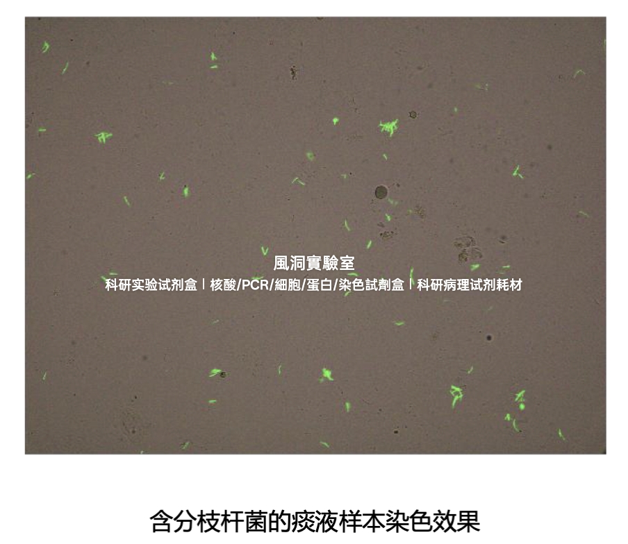 AIE抗酸染色液(AIE荧光染色法)适用痰液样本快速分辨检测分枝杆菌