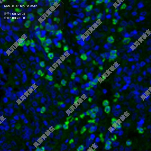 Anti -IL-10 Mouse mAb，抗 -IL-10 小鼠 mAb，50μL/100μL