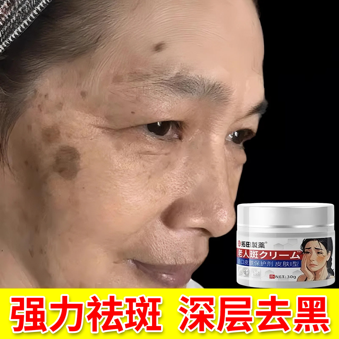 强力去老人斑老年斑专用膏去除点一擦祛就掉手部脸部抹净药除黑班