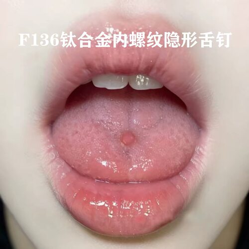 F136植入级内螺纹隐形舌钉肉粉