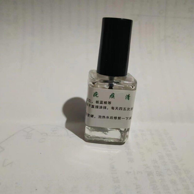 去除甲周疣瘊子手脚身体