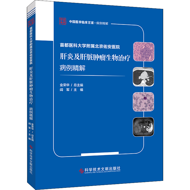 首都医科大学附属北京佑安医院肝炎及肝脏肿瘤生物治疗病例精解 闾军 编 医学内科学医师资料专业书籍 科学技术文献出版