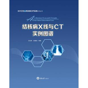 吕圣秀 呼吸科医师专业参考书籍 陈耀凯 其他结核性胸膜疾病X线及CT影像学资料 结核病防治专业图书 肺结核 结核病线与实例图谱