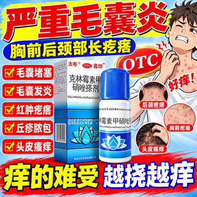 [鑫烨]克林霉素甲硝唑搽剂0.8%1%*20ml*1瓶/盒