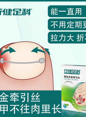 行健足科甲沟嵌甲记忆钢丝