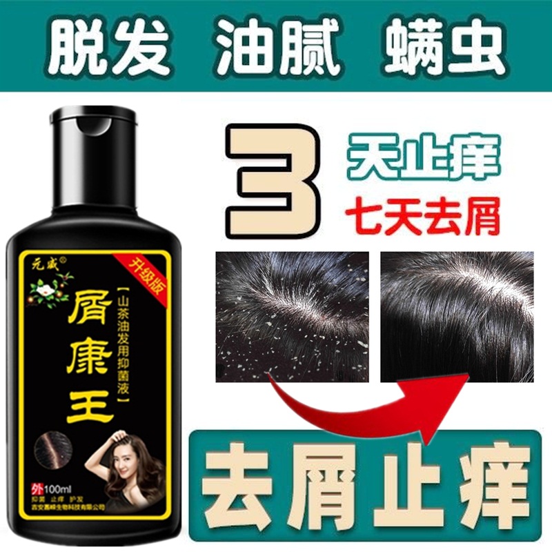 元威屑康王去屑洗发水清洁头皮