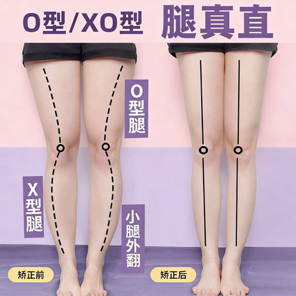 成人直腿神器o型X型小腿外翻矫正鞋垫扁平足弓支撑垫鞋防止鞋底磨