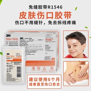 3M皮肤伤口胶带拉合小伤口防增生手术疤痕贴低敏美容减张免缝胶贴