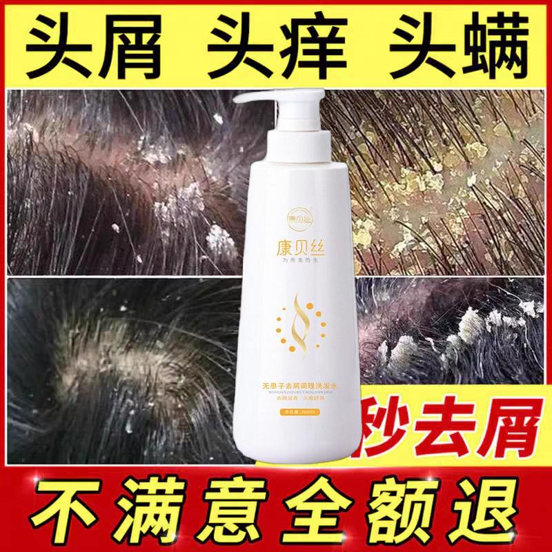 康貝絲無患子去屑調(diào)理洗發(fā)水除螨止癢殺菌抑菌大塊頭屑毛囊炎疙瘩