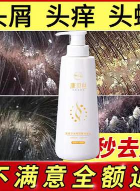 康贝丝无患子去屑调理洗发水除螨止痒杀菌抑菌大块头屑毛囊炎疙瘩
