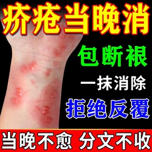 疥疮膏疥疮专用特效药皮肤剧烈瘙痒疥疮结节丘疹水泡硫磺软膏20%