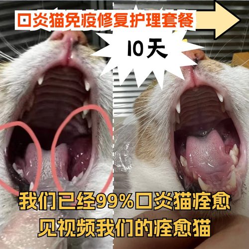 博莱得利口炎护理组合套餐