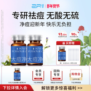 【送正装】泽平大痘净精露祛痘精华液改善青春痘闭口粉刺控油祛痘