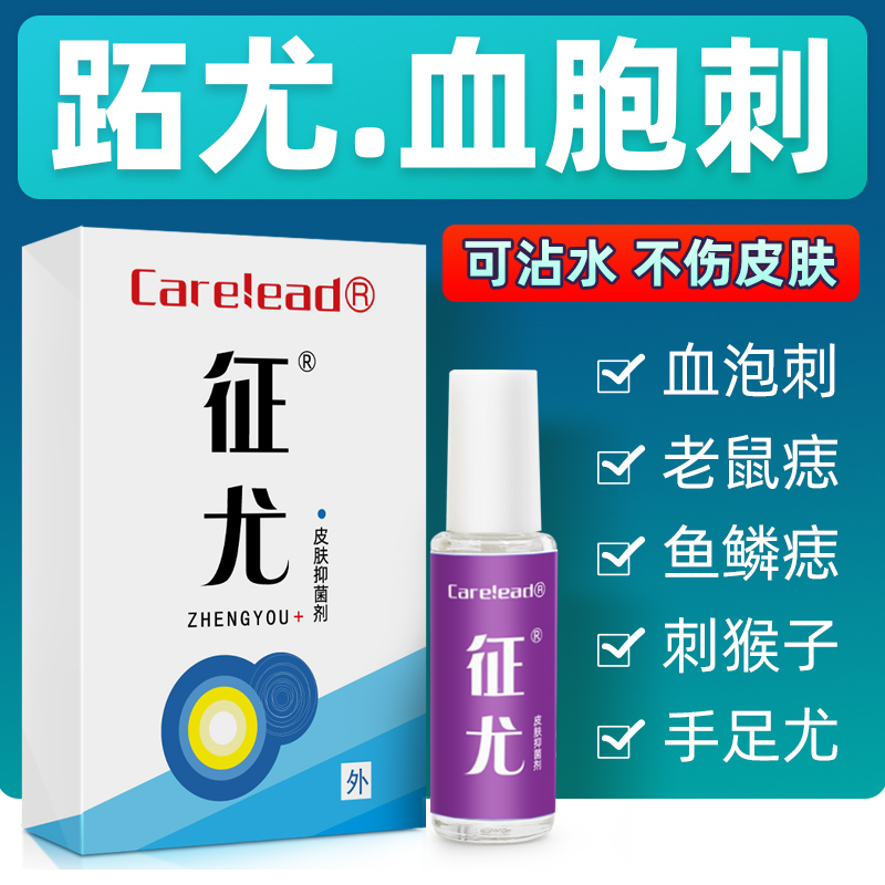 血胞刺老鼠痣鱼鳞痣刺猴去除膏