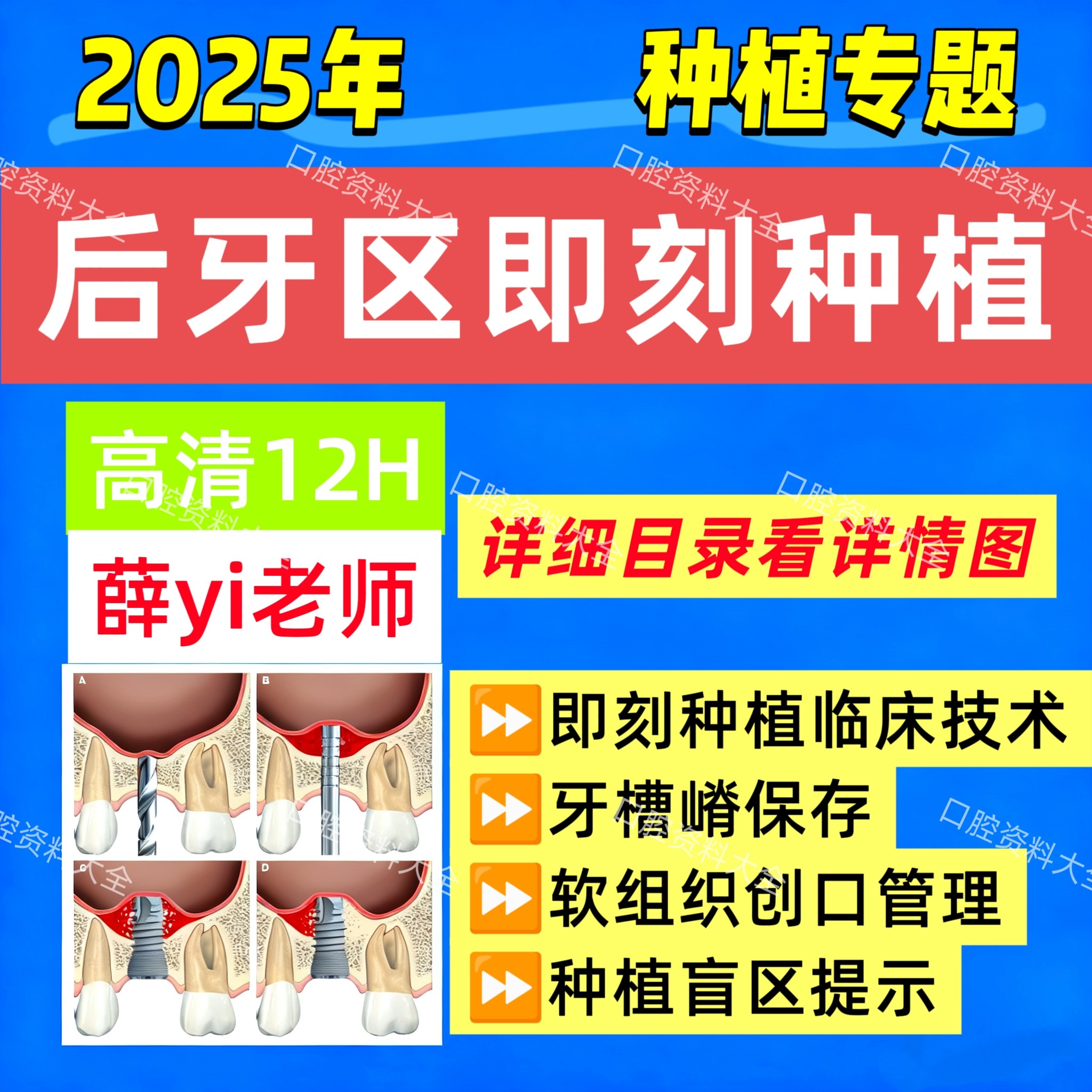 25年新即刻种植视频课程即刻负重即刻拔牙种植操作步骤即刻种植