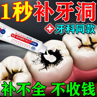 日本牙齿修复凝胶补牙树脂日本进口洞神器材料自己在家医用填充剂
