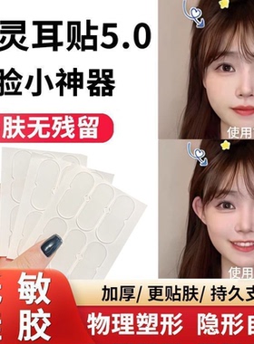 定型耳贴大脸显小强支撑