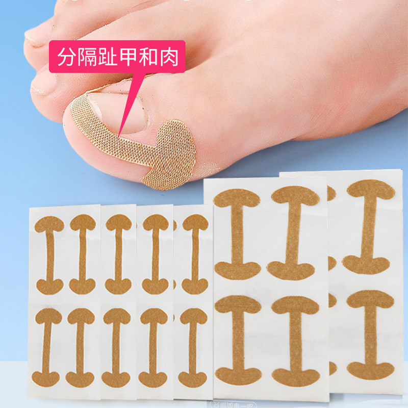 甲沟神器指甲矫正器隔离脚趾