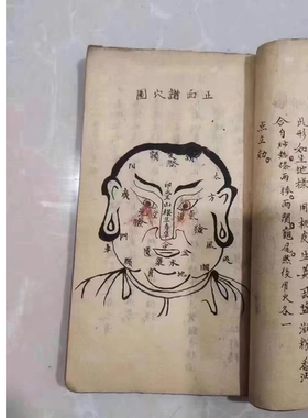 绝版古籍医书《火炙神书》老中医手抄本出售黑白复印本 印刷制品