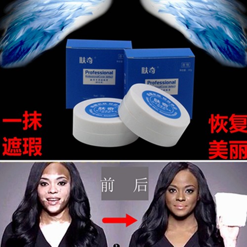 肤奇无味遮挡白斑美黑防水遮盖膏