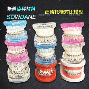 牙科正畸矫正金属陶瓷对比模型齿科牙模透明医患沟通教学