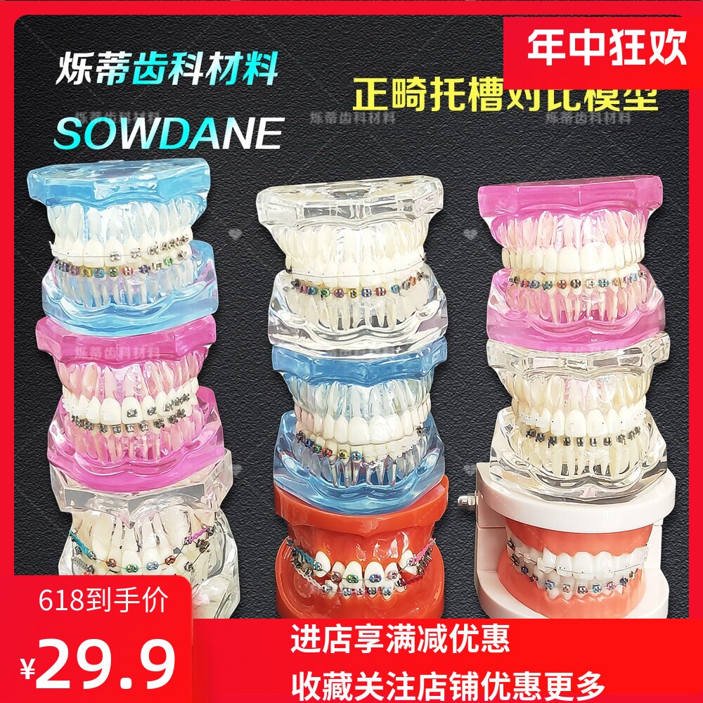 牙科正畸矫正金属陶瓷对比模型齿科牙模透明医患沟通教学