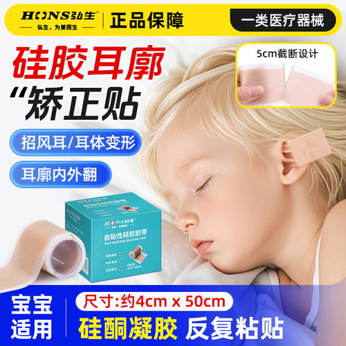 婴儿耳廓外翻矫正贴儿童宝宝招风耳呼吸贴耳朵胶带医用自粘硅胶布