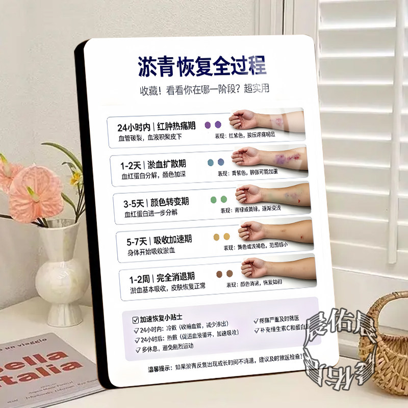 淤青恢复全过程健康管理馆淤青变化知识科普图解版相框装饰画摆件