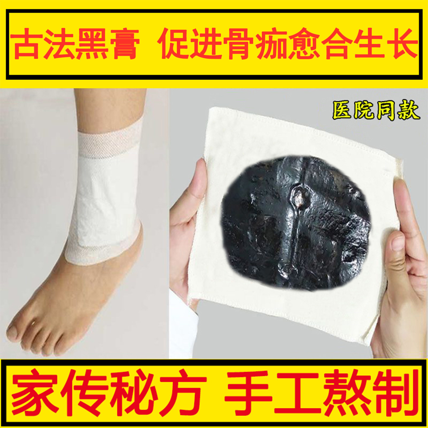陈旧伤筋骨伤裂恢复药快速接骨韧带拉伤折膏脚踝扭伤崴伤专用膏贴
