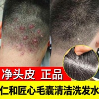 仁和匠心毛囊洗发水除螨头部深层清洁控油止头皮痒洗发露官方正品