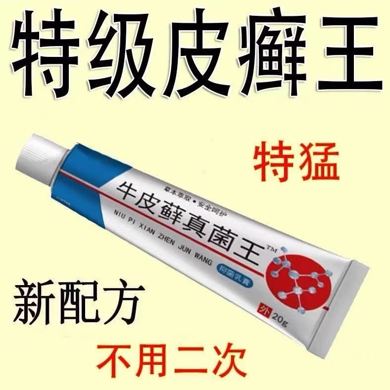 牛皮癣专用膏癣手足癣湿疹专用皮肤瘙痒抑菌止痒特效