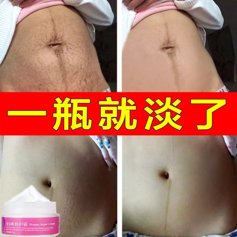[d[s119672166]妊娠纹护理]孕妇专用产后去除妊娠纹修复霜橄榄油消月销量0件仅售48.94元
