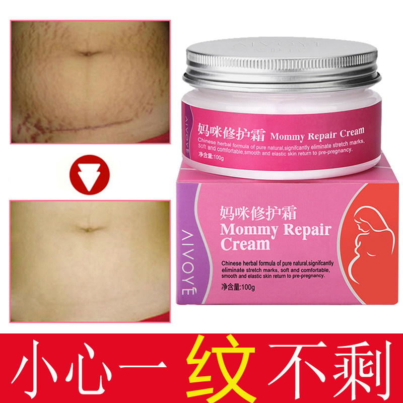 [d[s119672166]妊娠纹护理]去妊辰纹祛妊娠纹产后消除修复霜生长纹月销量0件仅售48.17元