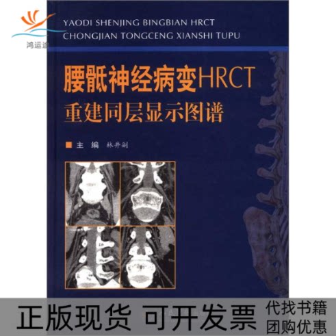 【正版书包邮】腰骶神经病变HRCT重建同层显示图谱林井副林井副人民军医出版社