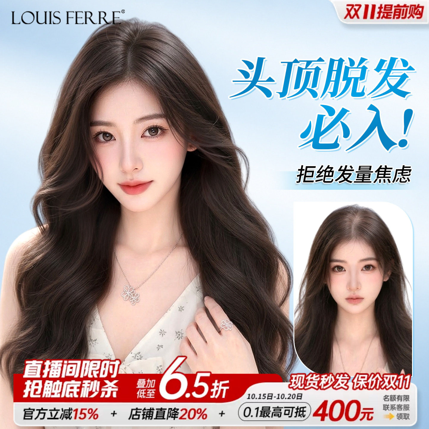 头顶脱发必入免发网假发片女全真人发遮白发长卷发补发片蓬松无痕