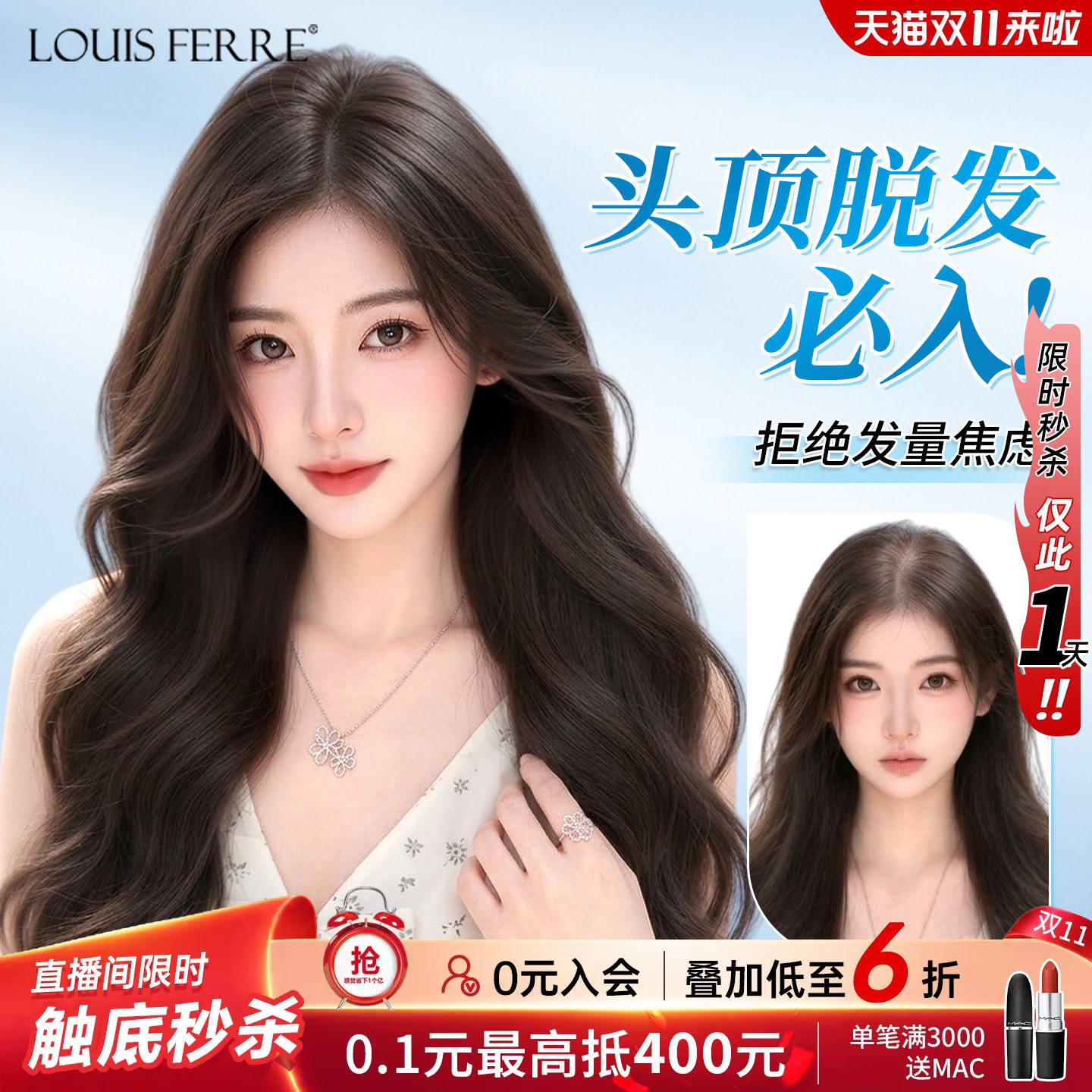 头顶脱发必入免发网假发片女全真人发遮白发长卷发补发片蓬松无痕