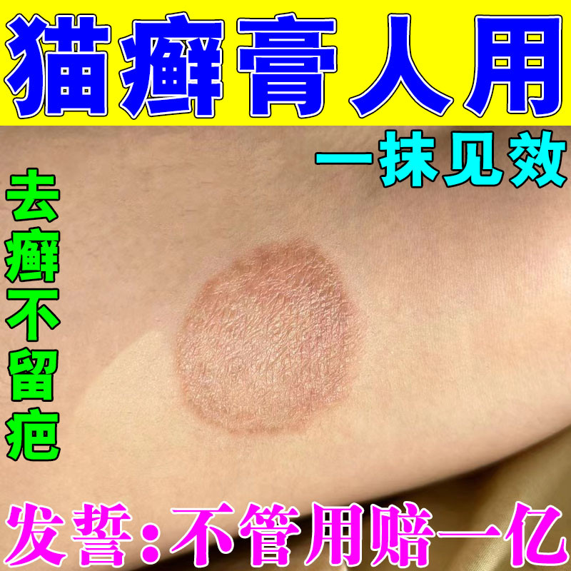 猫癣专用特效药治疗猫癣人用的药皮肤病真菌感染瘙痒宠藓净外用药