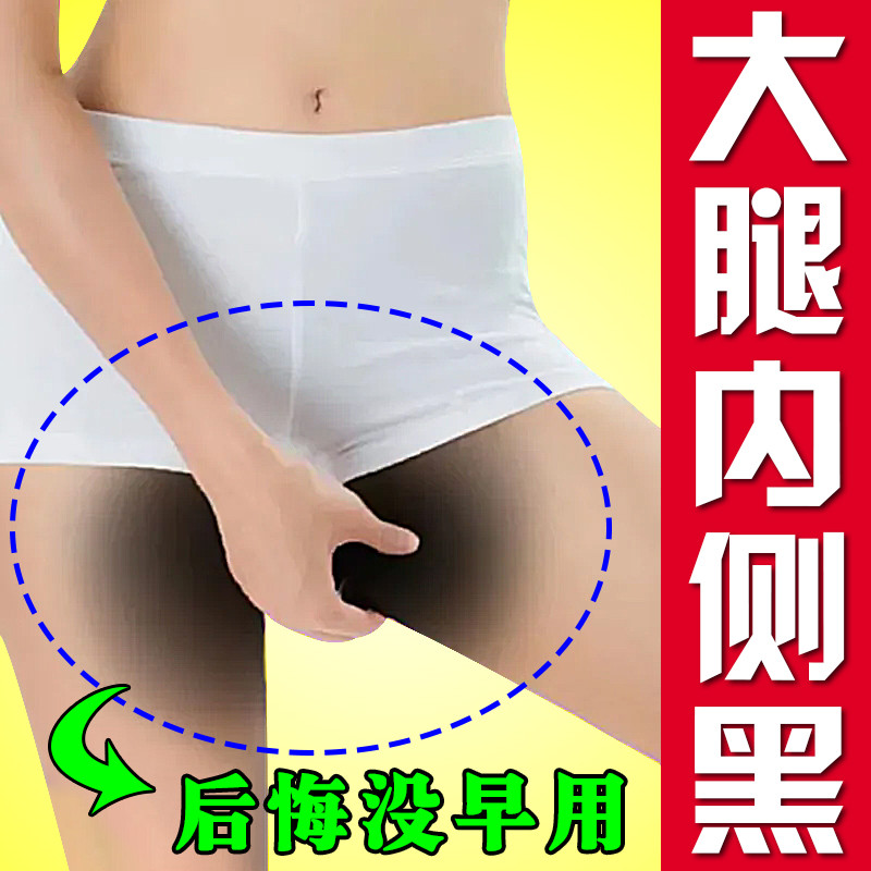 大腿根部去黑内侧腋下美白去黑腋窝除黑色素沉淀按摩膏久坐屁股黑