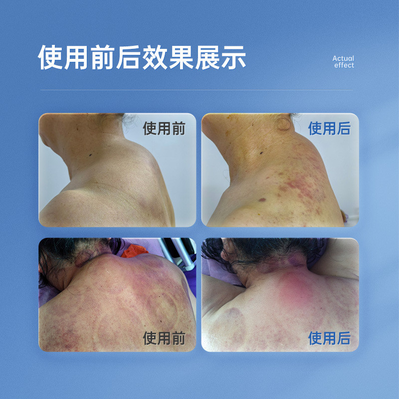 热销三通大师灸导仪生物电疏通经络按摩身体养生仪器手提箱养生仪