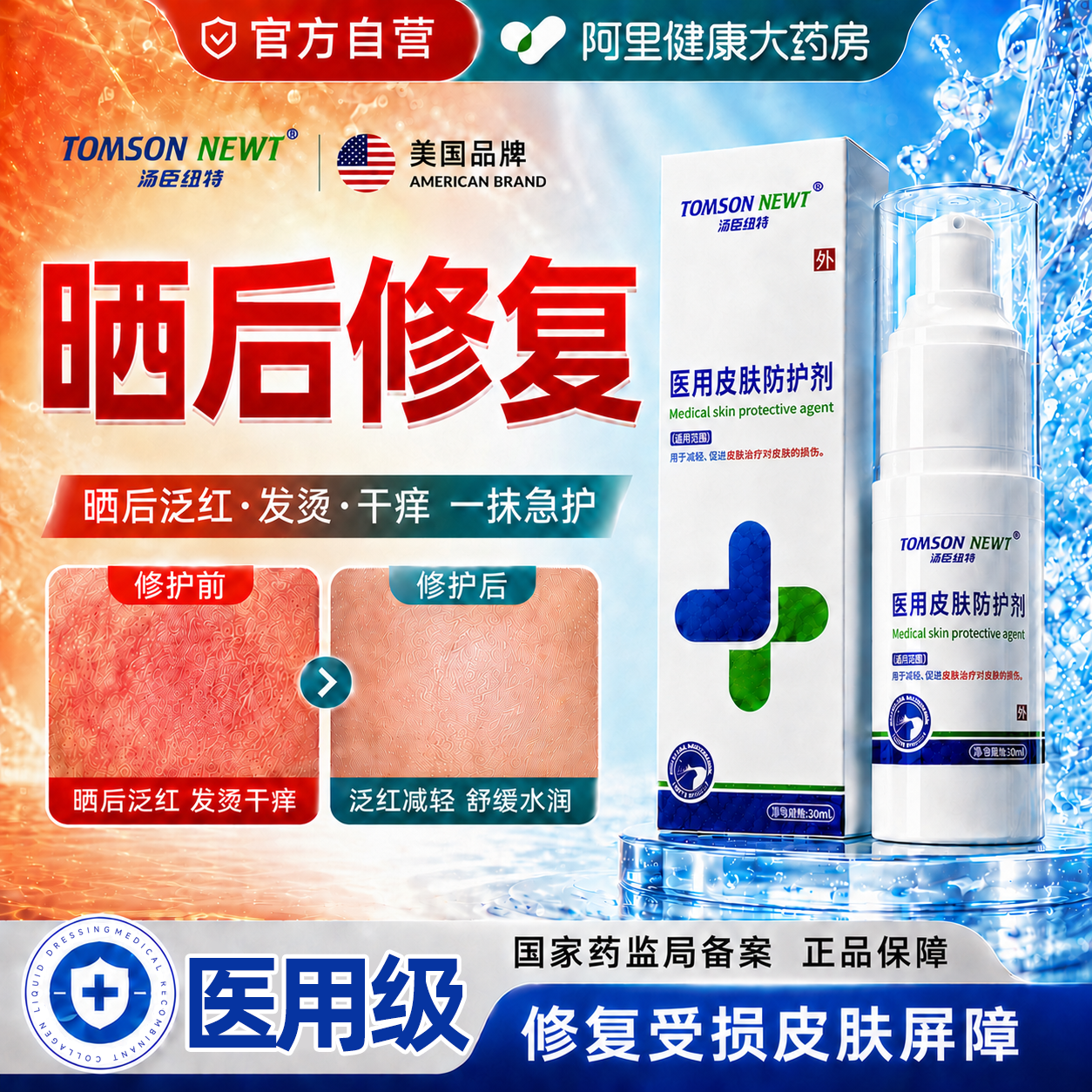 晒后修复芦荟胶皮肤晒伤药膏凝胶急救医用日光性皮炎紫外线过敏膏