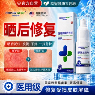 晒后修复芦荟胶皮肤晒伤药膏凝胶急救医用日光性皮炎紫外线过敏膏