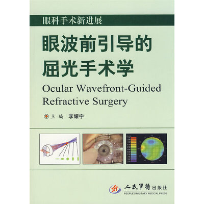 眼科手术新进展眼波前引导的屈光手术