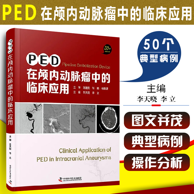 正版 PED在颅内动脉瘤中的临床应用 50个经典案例 李晓天 李立 主编 脑实质出血 Pipeli 书籍/杂志/报纸 临床医学 原图主图