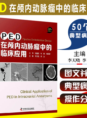 正版 PED在颅内动脉瘤中的临床应用 50个经典案例 李晓天 李立 主编 脑实质出血 Pipeli